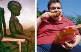 Obesity and Hunger